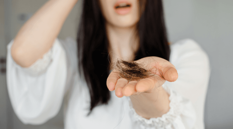 queda-de-cabelo-1-800x445_010930