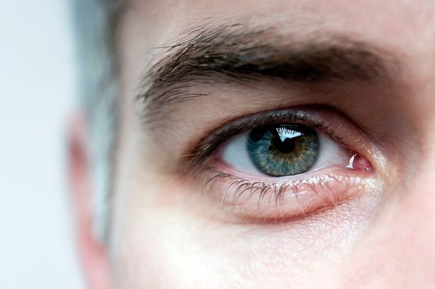 وميض العين: أسبابه وأعراضه وطرق الوقاية منه