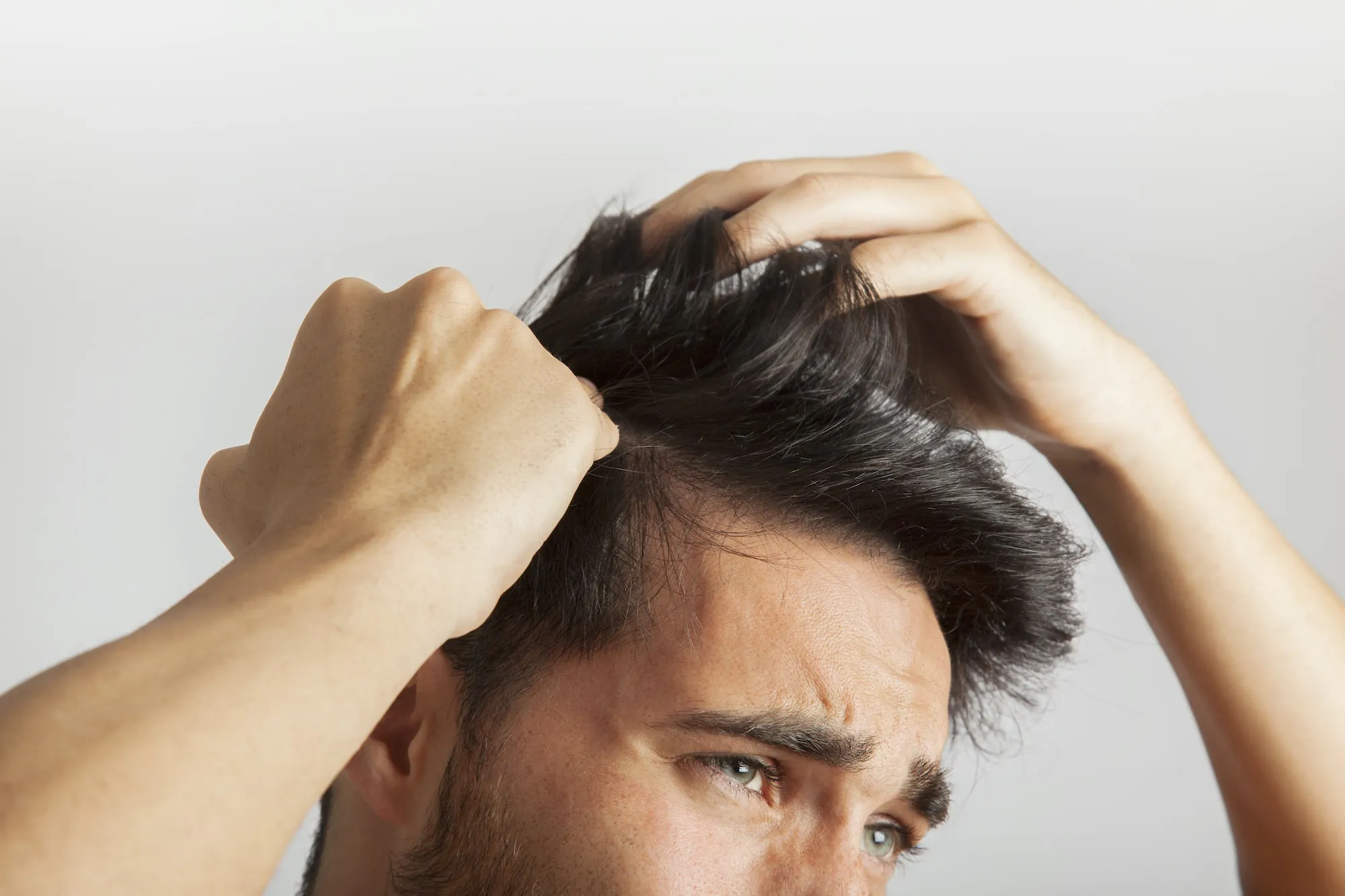 حلول طبيعية لمشكلة قشرة الشعر المزعجة