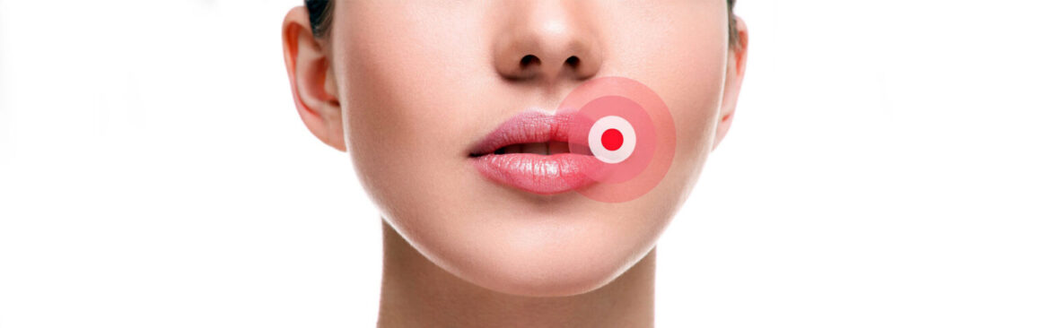 swollen lip in the morning 1536×480 123005 swollen lip in the morning 1536x480 123005