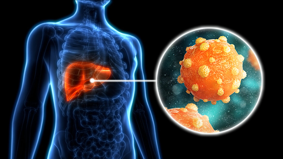 what is hepatitis b thumbnail 123007 what is hepatitis b thumbnail 123007